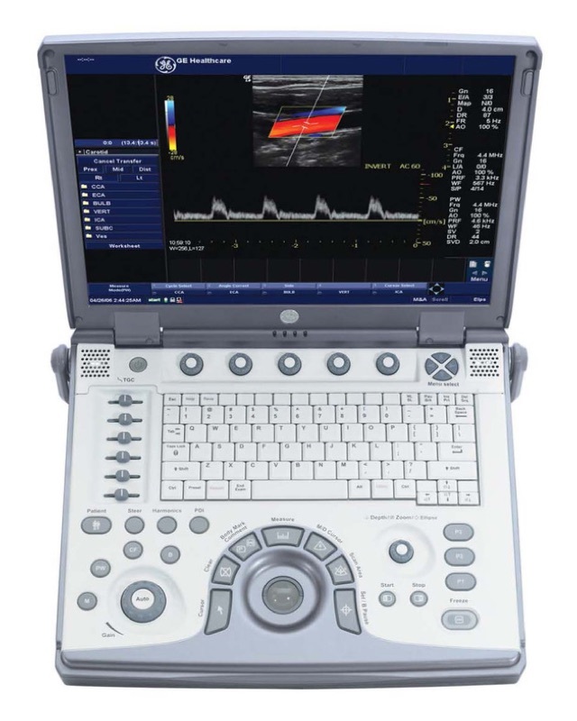 GE LOGIQ-e BT11 Ultrasound Machine – OB/GYN – Refurbished by GE in 2017, OB/GYN/Vascular Package, Color Doppler, PW Doppler, M-Mode, Angio, Tissue Harmonics, Easy 3D DICOM, Anatomic M-Mode, LogiqView, CrossXbeam, Auto Tissue Optimization