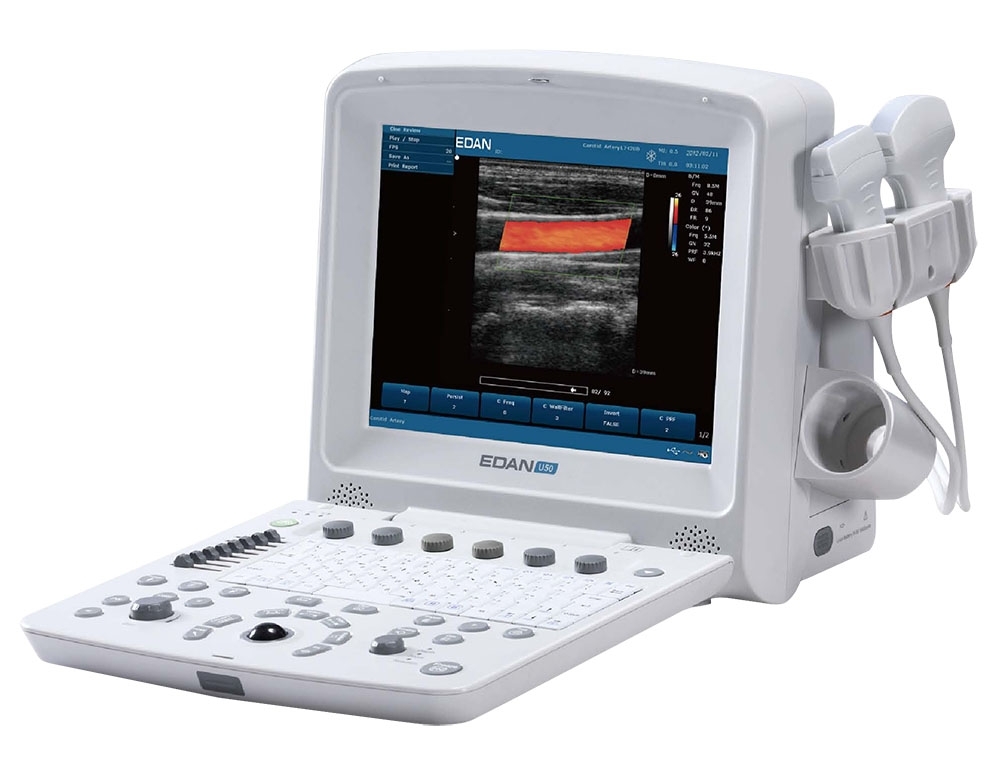 Edan U50 Diagnostic Ultrasound System # U50Prime - Each